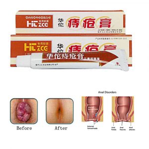 Chinese Hemorrhoids Cream review